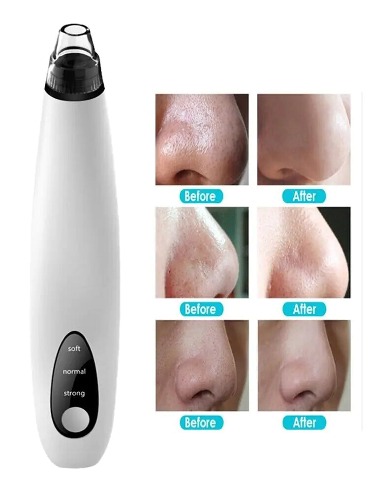 Diamond Pore Cleansing Vacuum