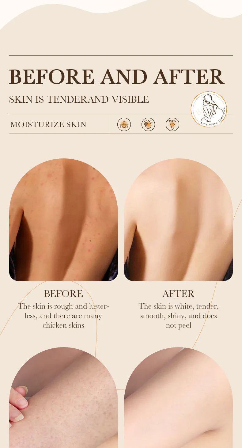 Rice Hydration &amp; Nourish Cream