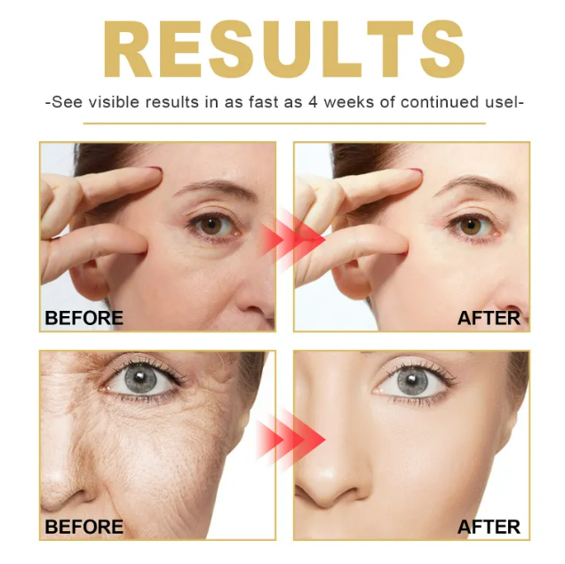 HydraSmooth Anti-Wrinkle Cream
