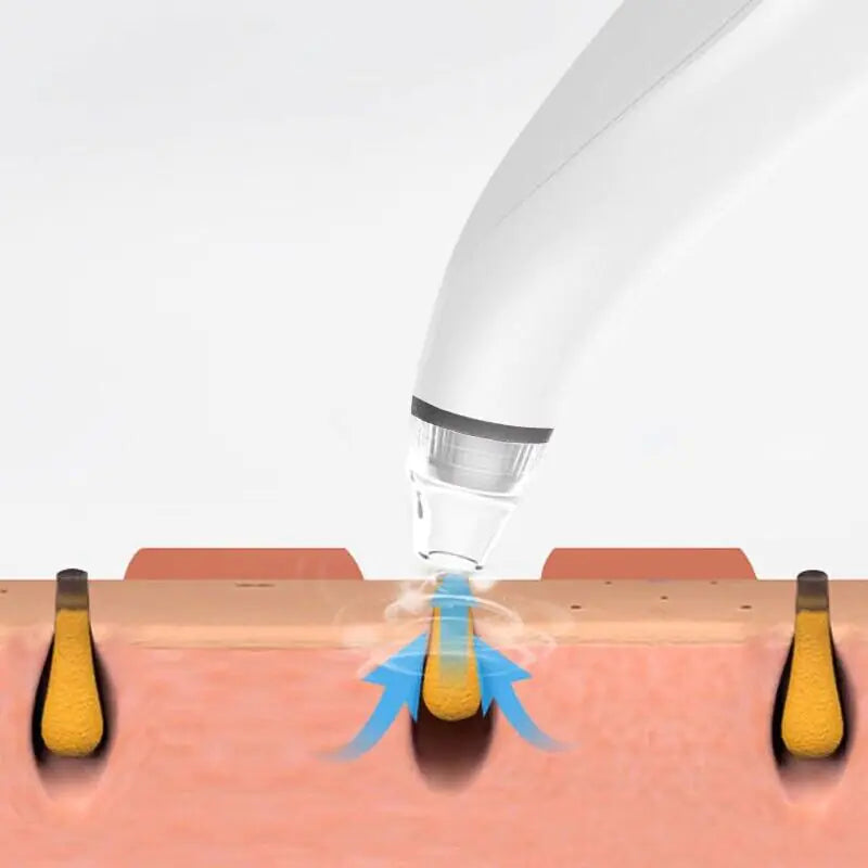 Diamond Pore Cleansing Vacuum