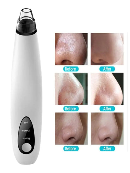Diamond Pore Cleansing Vacuum